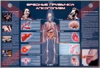 Электрифицированный стенд "Вредные привычки: алкоголизм" - «globural.ru» - Казань