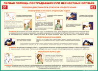 Таблица Порядок действий при опасном кровотечении 1000*1400 винил - «globural.ru» - Казань