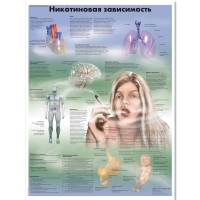 Плакат "Никотиновая зависимость", ламинированный, 50*67 см - «globural.ru» - Казань
